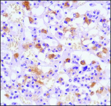 Anti-Luteinizing Hormone antibody, Rabbit monoclonal