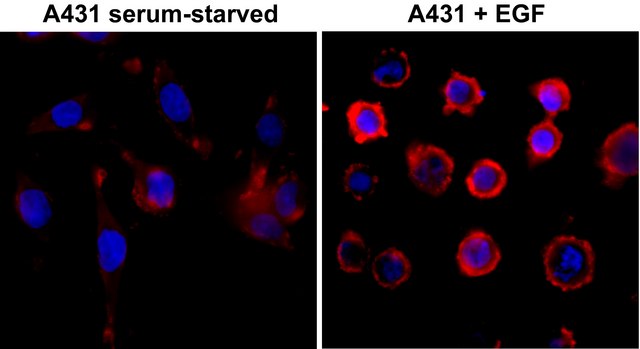Anti-Phosphotyrosine antibody, Rabbit monoclonal