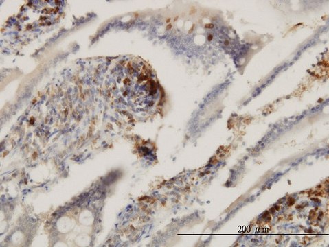 Monoclonal Anti-ENTPD6 antibody produced in