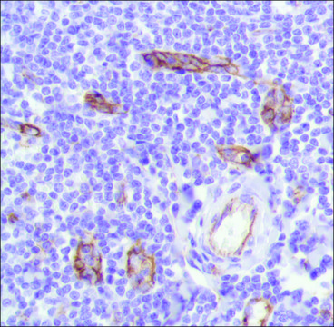 Anti-CD31 antibody, Rabbit monoclonal