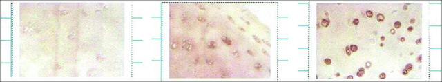 Monoclonal Anti-SOD3 antibody produced in