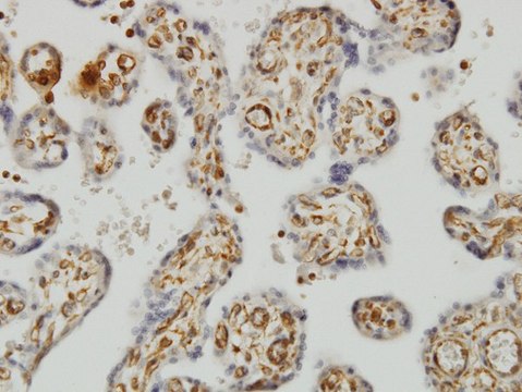 Monoclonal Anti-SHMT1 antibody produced in