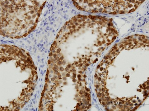 Monoclonal Anti-STIP1 antibody produced in