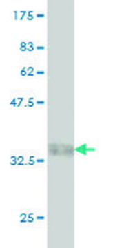 Monoclonal Anti-GUCA1B antibody produced in