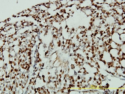 Monoclonal Anti-CDKN1B antibody produced in