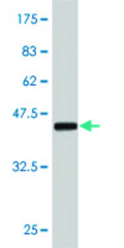 Monoclonal Anti-ERBB2 antibody produced in
