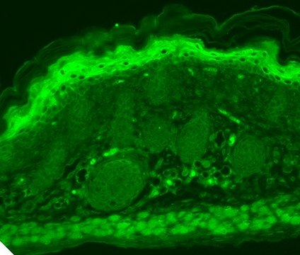 Monoclonal Anti-TRPV3 antibody produced in