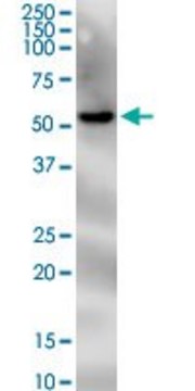 Monoclonal Anti-PNPLA2 antibody produced in