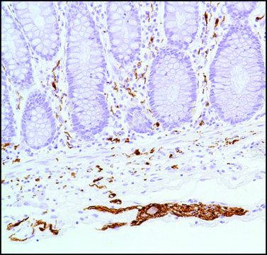 Anti-S100 Beta antibody, Rabbit monoclonal