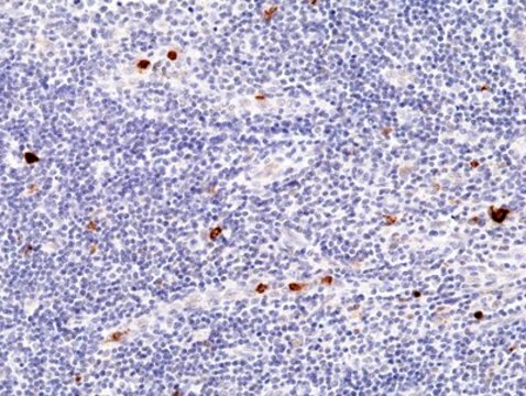 Anti-Myeloperoxidase (MPO) Rabbit Monoclonal Antibody