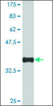 Monoclonal Anti-NSD1 antibody produced in