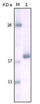 Monoclonal Anti-DDR2 antibody produced in