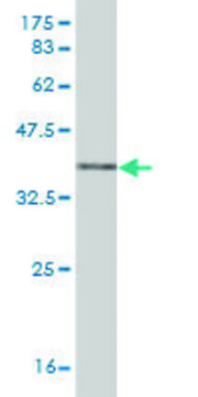 Monoclonal Anti-MMP13 antibody produced in