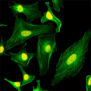 Anti-Core Histone Macro-H2A.1 antibody, Rabbit