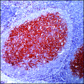 Anti-CD23 antibody, Rabbit monoclonal