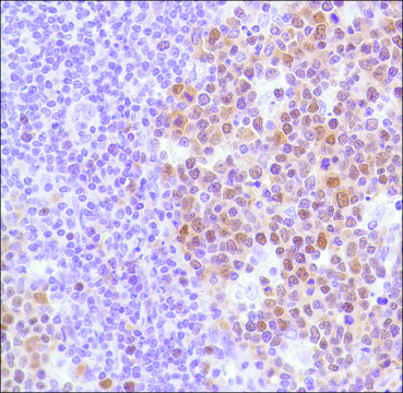 Anti-BCL-6 antibody, Rabbit monoclonal