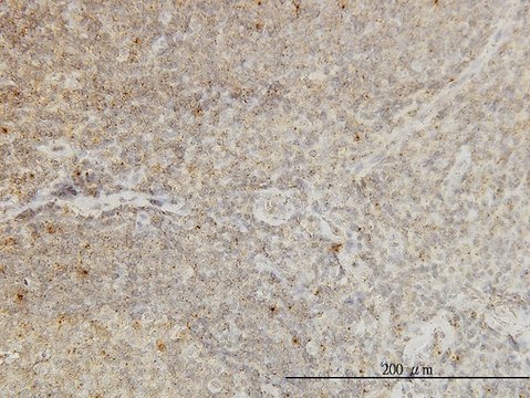 Monoclonal Anti-CDKL4 antibody produced in