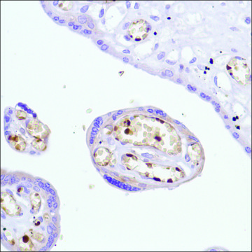 Anti-Haemoglobin Alpha Chain antibody, Rabbit