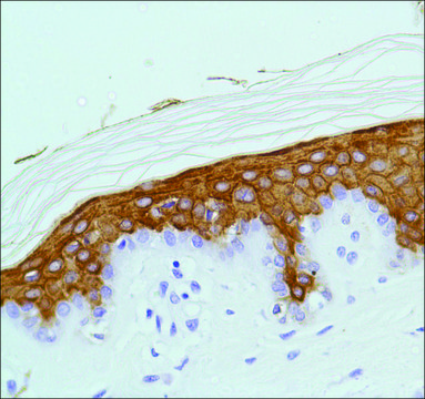 Anti-Keratin 10 antibody, Rabbit monoclonal