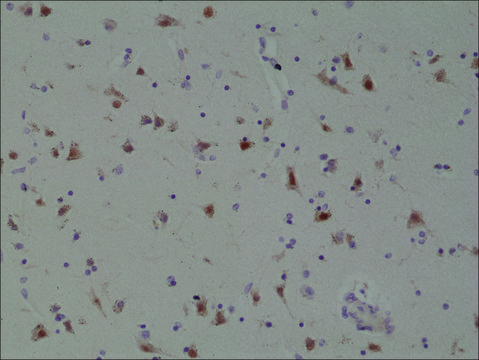 Anti-SATB2 antibody, Rabbit monoclonal
