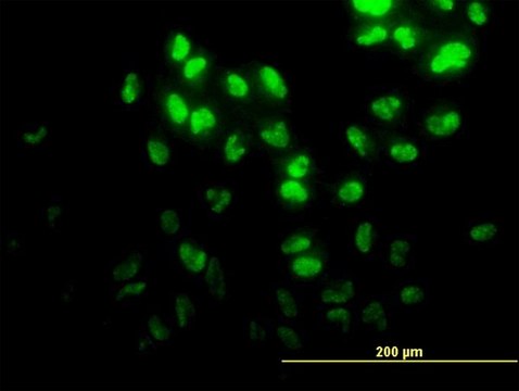 Monoclonal Anti-DPH2 antibody produced in
