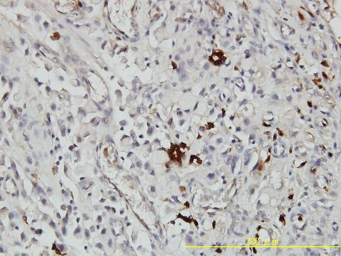 Monoclonal Anti-ORM1 antibody produced in