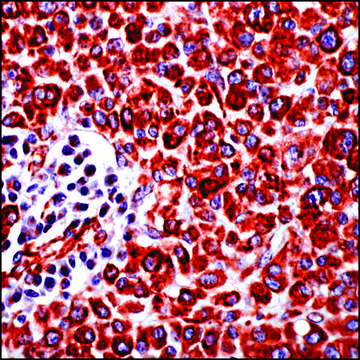 Anti-Vimentin antibody, Rabbit monoclonal