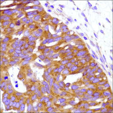 Anti-URI antibody, Rabbit monoclonal