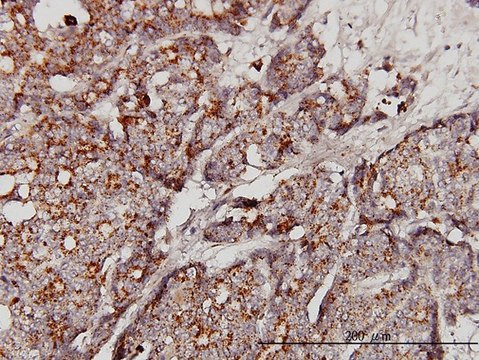 Monoclonal Anti-GBA antibody produced in