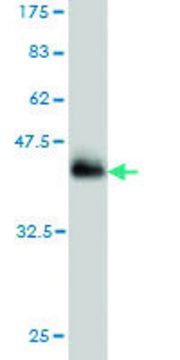 Monoclonal Anti-NSDHL antibody produced in