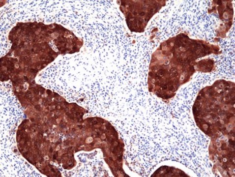 p16 INK4a Rabbit Monoclonal Antibody