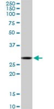 Monoclonal Anti-C1QTNF1 antibody produced in