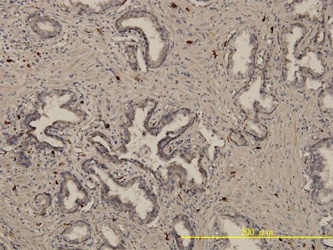Monoclonal Anti-EML4 antibody produced in
