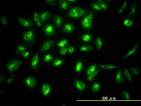Monoclonal Anti-COG7 antibody produced in