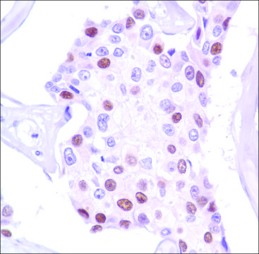 Anti-Progesterone Receptor antibody, Rabbit monoclonal