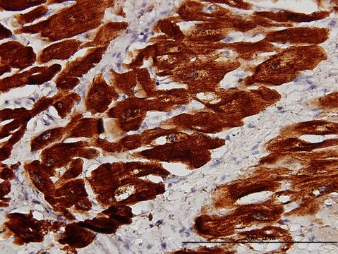 Monoclonal Anti-TNNC1 antibody produced in