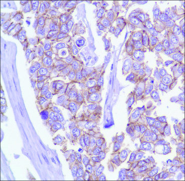 Anti-P120 (Catenin delta 1) antibody,