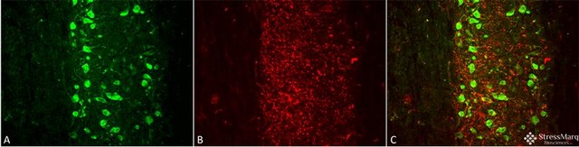 Monoclonal Anti-Mmp9 antibody produced in