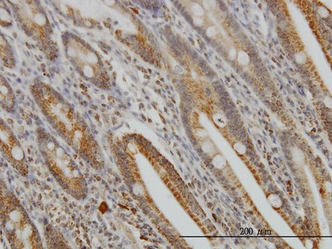 Monoclonal Anti-GMPS antibody produced in
