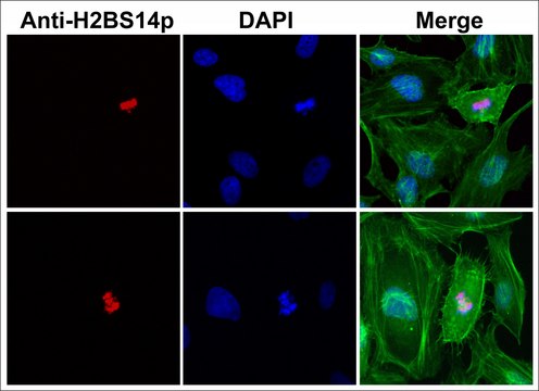 Anti-Phospho-Histone H2B (Ser14) antibody, Rabbit