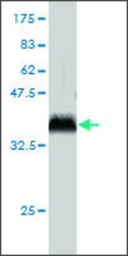 Monoclonal Anti-RCHY1 antibody produced in