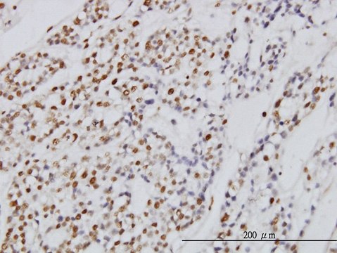 Monoclonal Anti-SYMPK antibody produced in