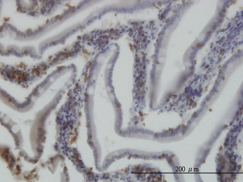 Monoclonal Anti-RICTOR antibody produced in