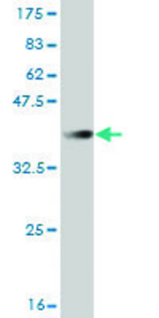 Monoclonal Anti-FBXL3 antibody produced in