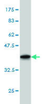Monoclonal Anti-GRK1 antibody produced in