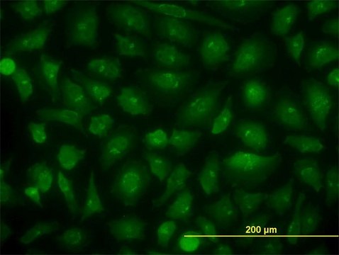 Monoclonal Anti-KIAA1967 antibody produced in