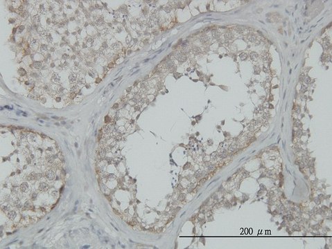 Monoclonal Anti-MAP3K4 antibody produced in