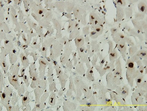 Monoclonal Anti-ACD antibody produced in
