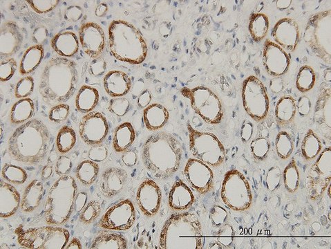 Monoclonal Anti-ACAA2 antibody produced in