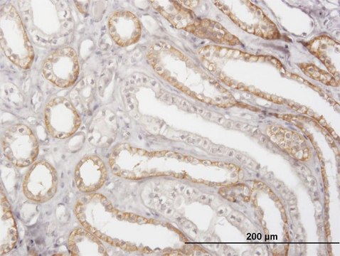 Monoclonal Anti-CTSK antibody produced in